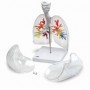 CT - Arbre bronchique avec larynx et poumon transparent 