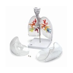 CT - Arbre bronchique avec larynx et poumon transparent 