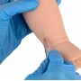 Bras d'injection sur le nourrisson