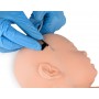 Bras d'injection sur le nourrisson