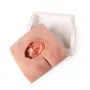 Modèle de plaie décubitus sacré nettoyé Erler Zimmer - Avec support