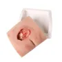 Modèle de plaie décubitus sacré nettoyé Erler Zimmer - Avec support