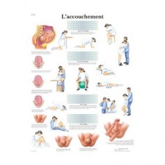 Planche anatomique L'accouchement