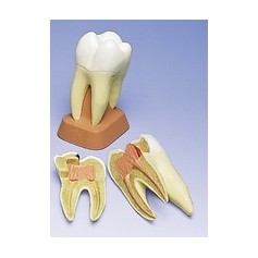 Molaire supérieure à trois racines, en 2 parties