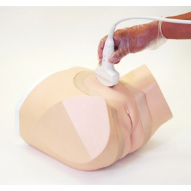 Sonde à Ultrasons Examen Pelvieb ERLER ZIMMER