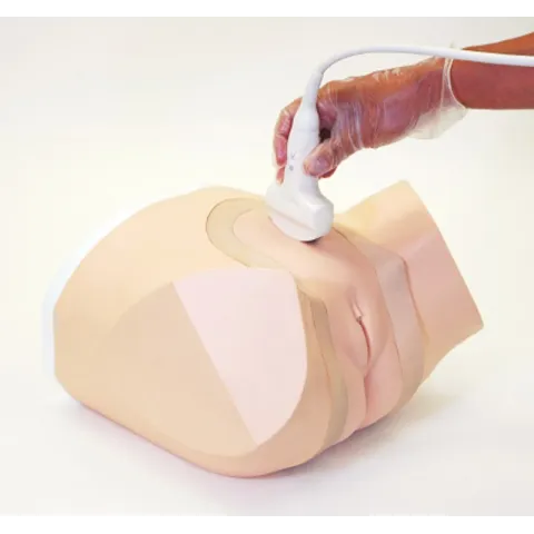 Sonde à Ultrasons Examen Pelvieb ERLER ZIMMER