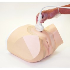 Sonde à Ultrasons Examen Pelvieb ERLER ZIMMER