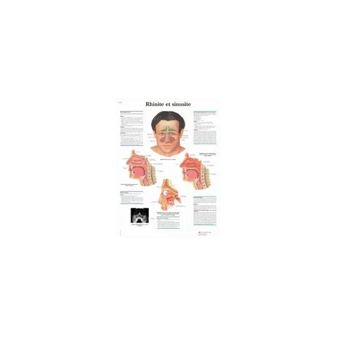 Rhinite et sinusite