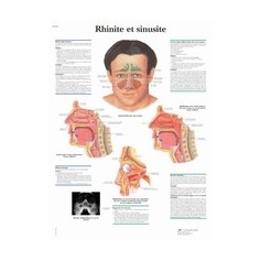 Rhinite et sinusite 