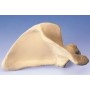 Scapula (Omoplate), droite 