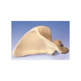 Scapula (Omoplate), droite 