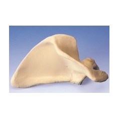 Scapula (Omoplate), droite 