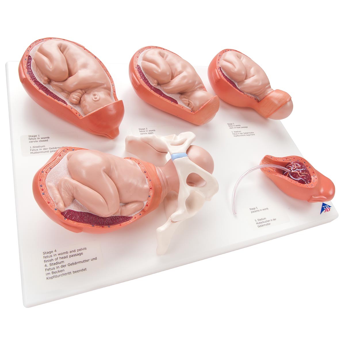 5 stades de l'accouchement modèles sur planche PVC