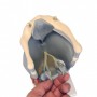 Larynx fonctionnel, agrandi 2,5 fois 