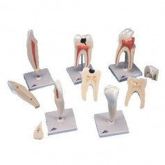Série de 5 modèles de dents