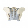 Modèle de bassin féminin avec ligaments erler zimmer