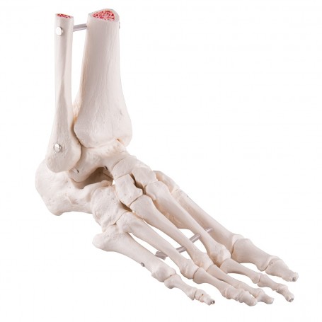 Squelette du pied avec moignon tibia et fibula (péroné) 