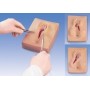 Suture post-épisiotomie, 3 pièces 