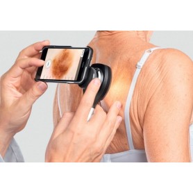 Coques d'adaptation pour dermatoscope Heine NC2