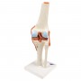 genou luxe model resine 