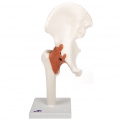 Articulation de la hanche modèle fonctionnel