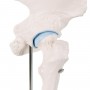 Mini-articulation de la hanche avec coupe transversale 