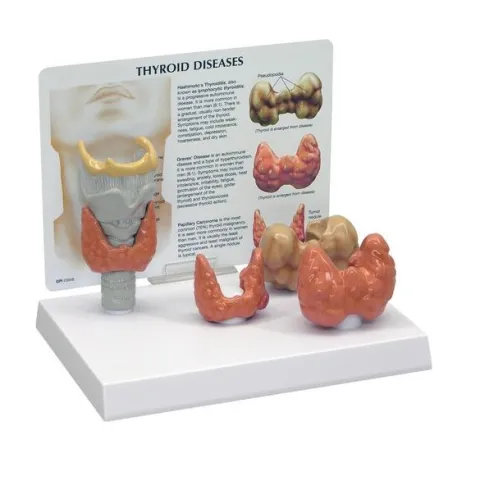 Modèle de thyroïde