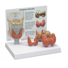 Modèle de thyroïde