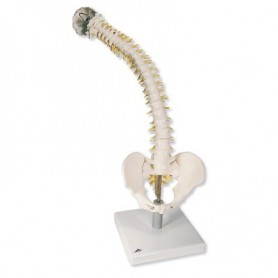 Colonne vertébrale flexible avec disques intervertébraux mou 