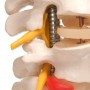Colonne vertébrale flexible pour la forte sollicitation 