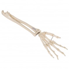 Squelette de la main avec radius et ulna (cubitus), montage 