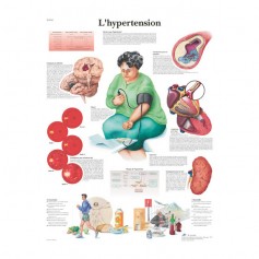 Planche anatomique - Hypertension