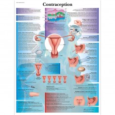 Planche anatomique la contraception