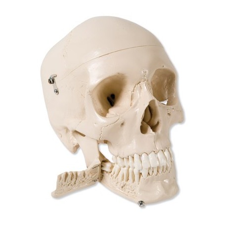 Crâne avec dents pour extraction, en 4 parties 
