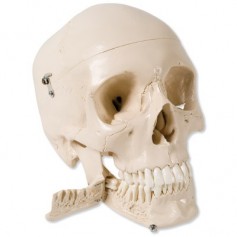 Crâne 3B Scientific avec dents pour extraction, en 4 parties