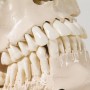 Crâne avec dents pour extraction, en 4 parties 
