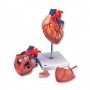 Coeur avec pontage, agrandi 2 fois, en 4 parties 