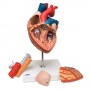 Coeur avec trachée et oesophage agrandi 2 fois, en 5 parties 