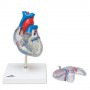 Coeur classique avec système de conduction 