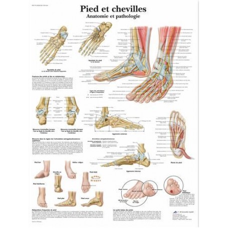 Planche anatomique Pied & Chevilles - Anatomie & Pathologie
