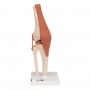 genou luxe model resine 