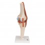 genou luxe model resine 