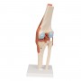 genou luxe model resine 
