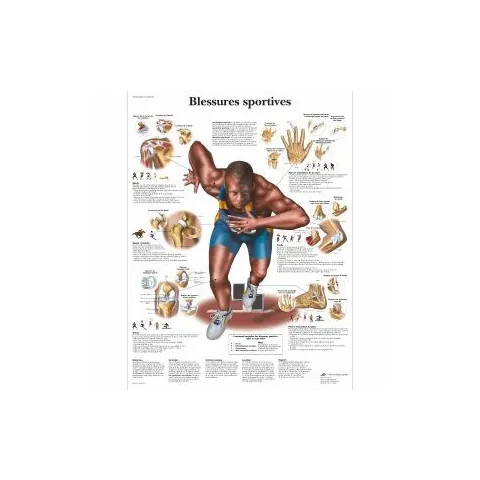 Planche anatomique blessures sportives
