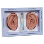 2 oreilles pour acupuncture 