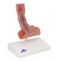 Affections de l'oesophage 