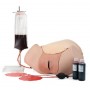 Simulateur d'hémorragie du postpartum - PPH Trainer P97