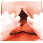 Simulateur d'hémorragie du postpartum - PPH Trainer P97