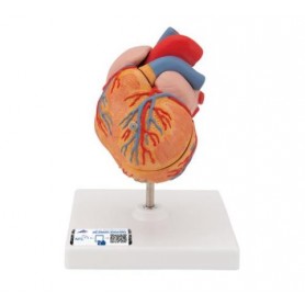 Coeur classique avec  HVG, en 2 parties 