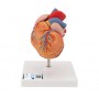 Coeur classique avec  HVG, en 2 parties 